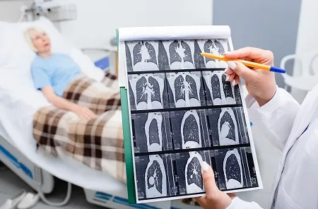 CT scan results
