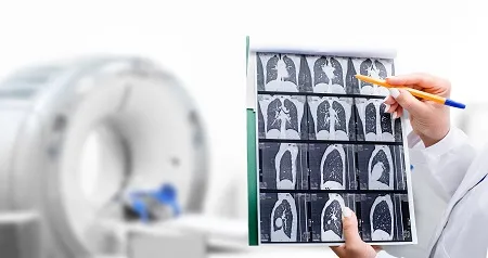 CT scan results